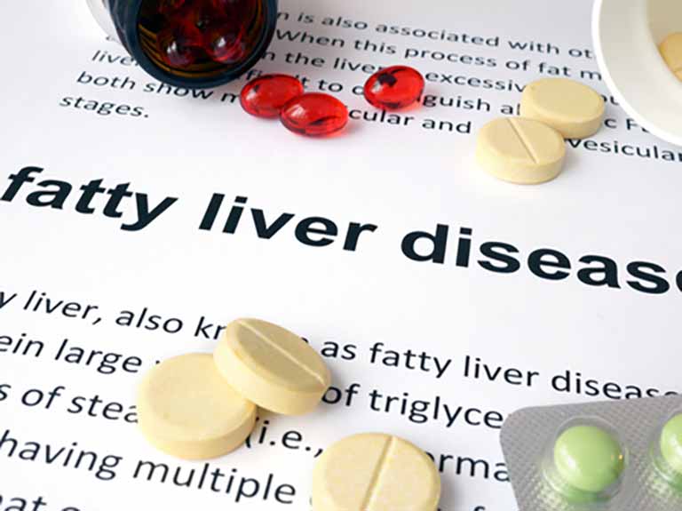 Fatty liver disease