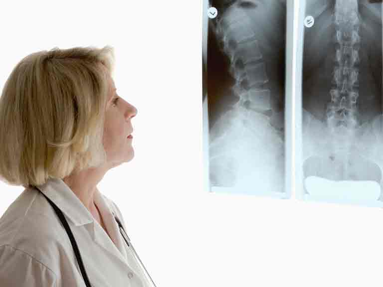 Doctor looking at a spinal x-ray
