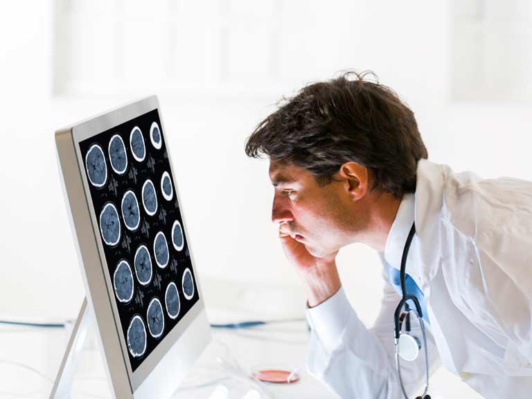Doctor looking at brain scan x-rays