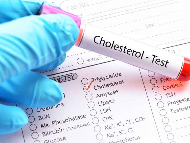 Cholesterol test