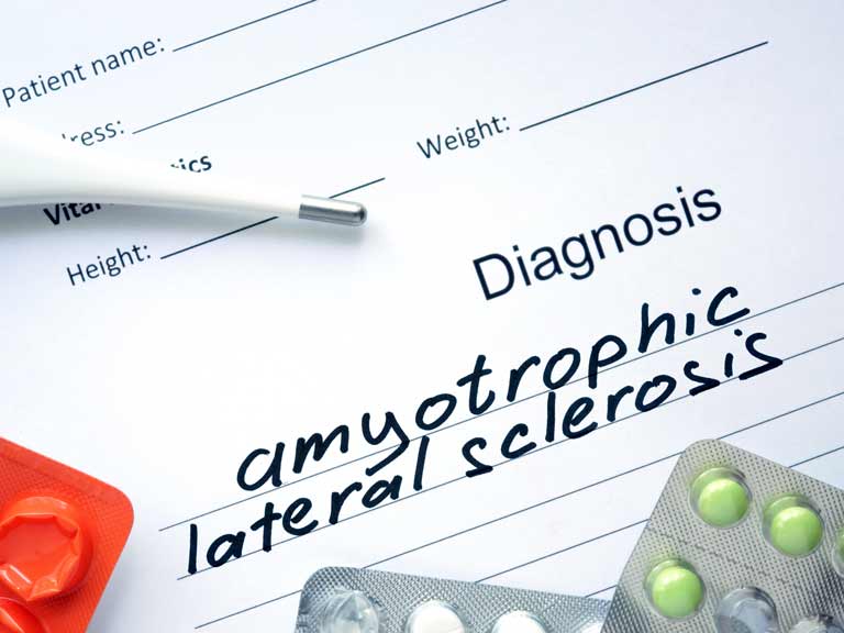 Amyotrophic lateral sclerosis ALS is the most common form, and affects about eight out of 10 people with MND.