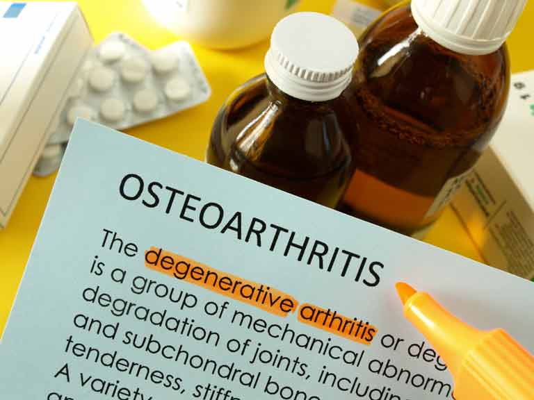 Osteoarthritis treatments