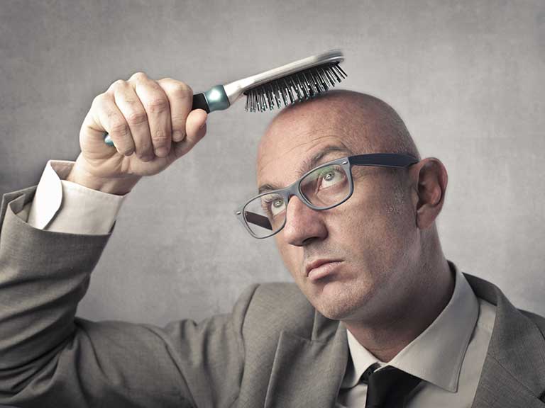 Dealing with thinning hair and male pattern baldness - Saga