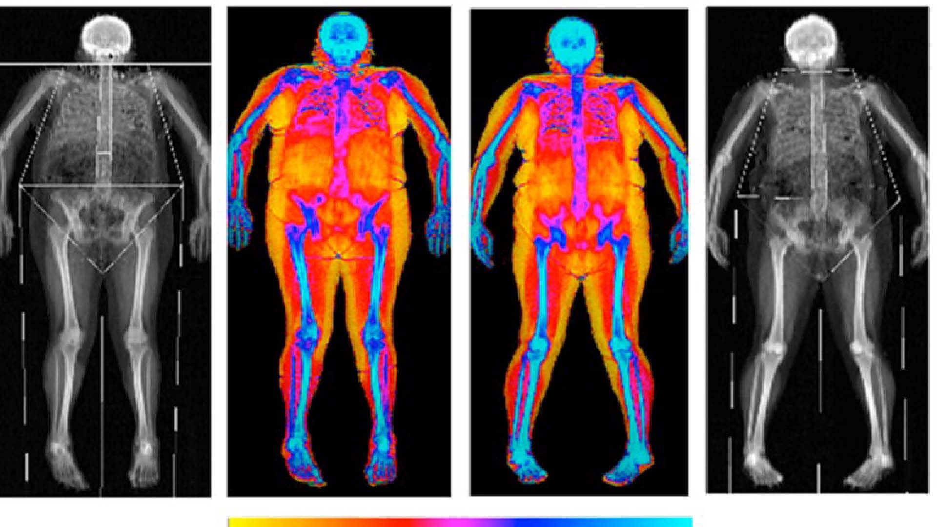 scan images of a large person and their body composition