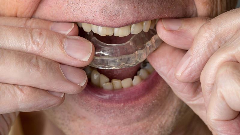 An older man puts a mouth guard into his mouth