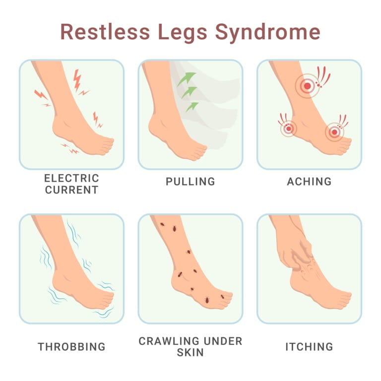 Illustrations of symptoms of restless leg syndrome