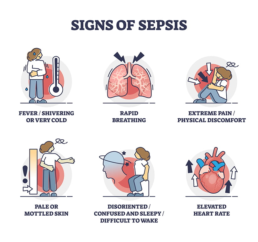 Illustrated symptoms of Sepsis