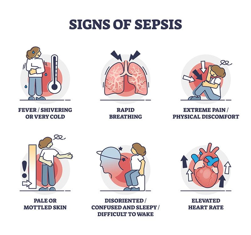Illustrated symptoms of Sepsis