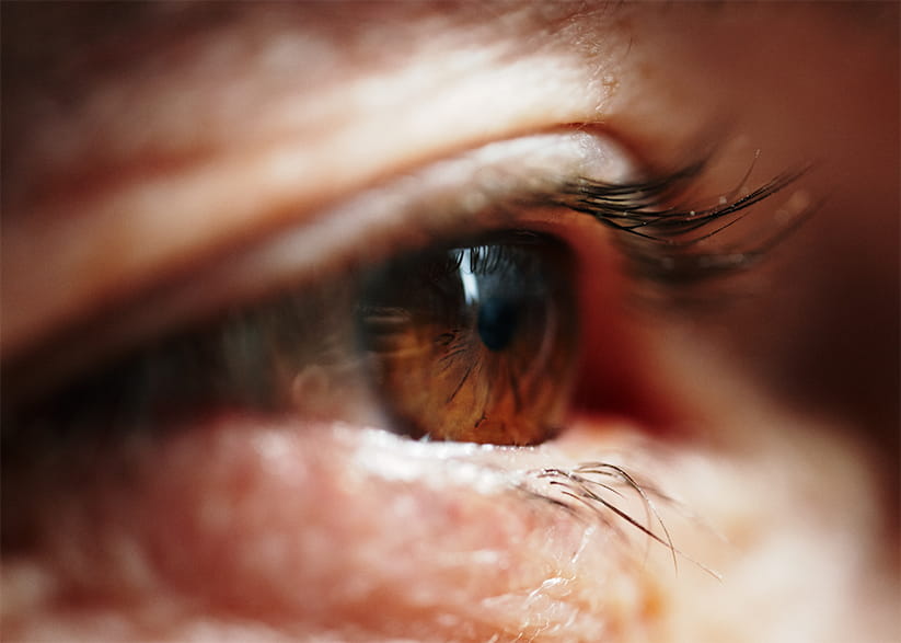 A close-up of an older persons brown coloured eye